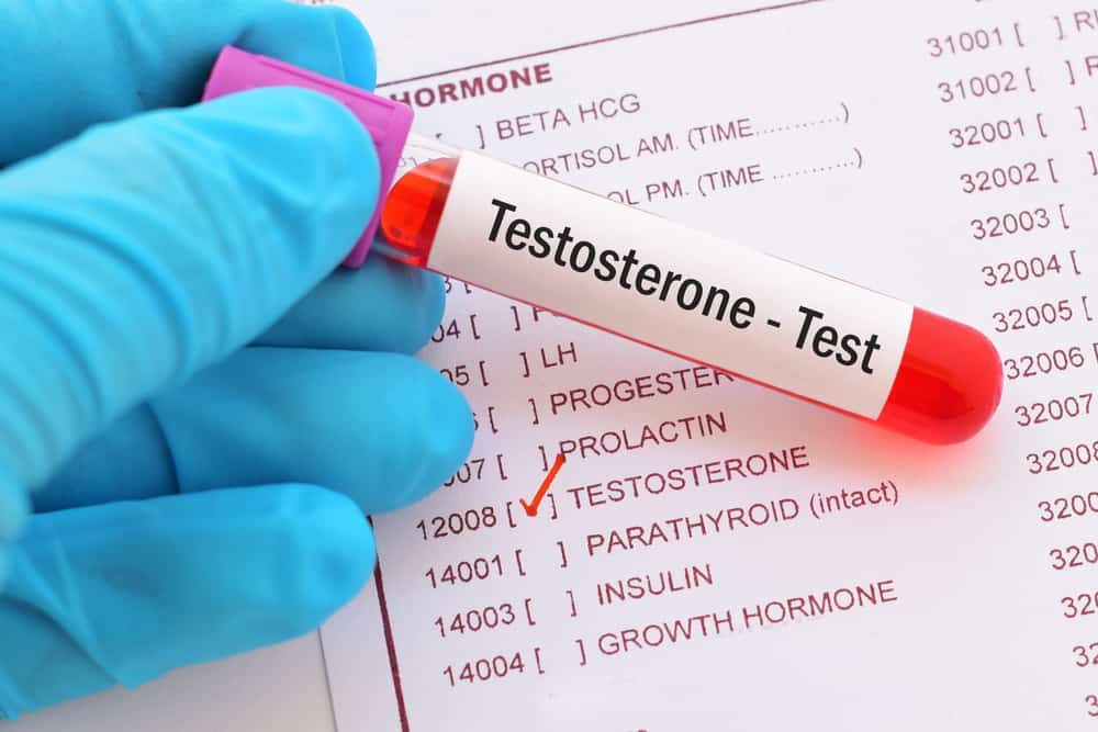Testosterone Test : टेस्टोस्टेरोन टेस्ट क्या है?