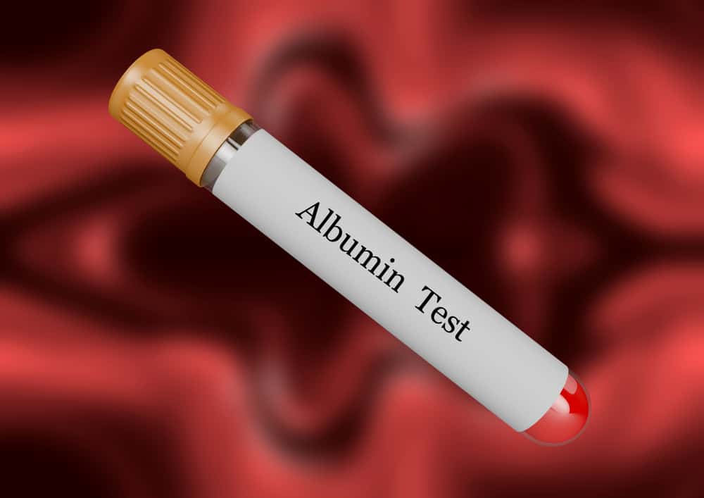Albumin Test : एल्बुमिन टेस्ट क्या है?