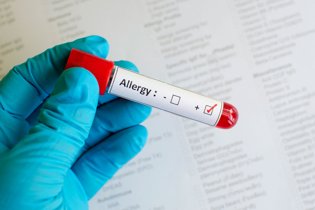 Allergy Blood Test, एलर्जी ब्लड टेस्ट