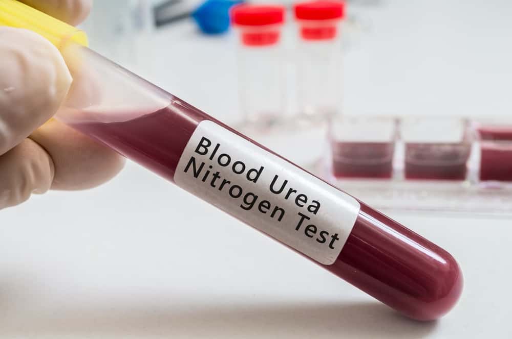 Blood Urea Nitrogen Test: ब्लड यूरिया नाइट्रोजन टेस्ट क्या है?