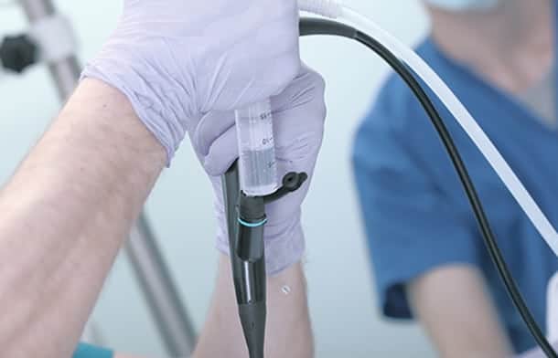 Cystoscopy : सिस्टोस्कोपी टेस्ट क्या है?