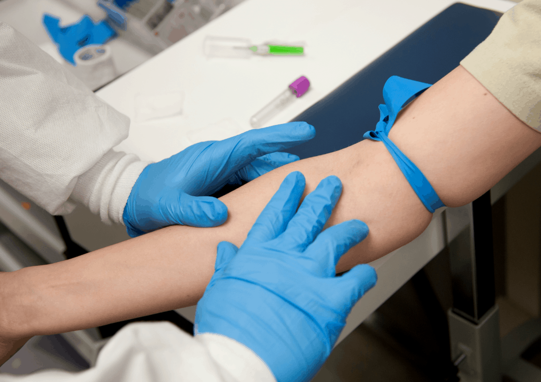 कैसे समझें कि आपका कोलेस्ट्रॉल बढ़ गया है? जानिए कोलेस्ट्रॉल बढ़ने के लक्षण