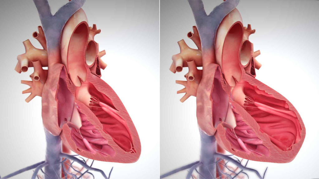 हृदय रोग - heart diseases