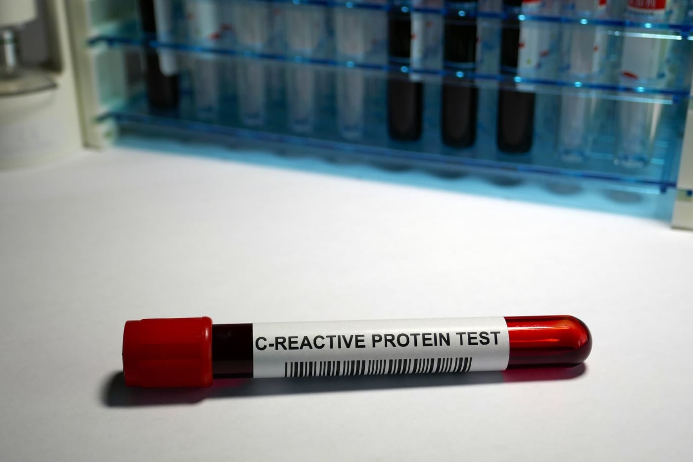 C Reactive Protein Test : सी रिएक्टिव प्रोटीन टेस्ट क्या है?