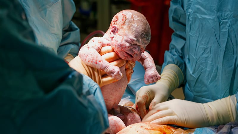 सी-सेक्शन डिलिवरी (सिजेरियन डिलिवरी) प्लान करने से पहले ध्यान रखें ये बातें