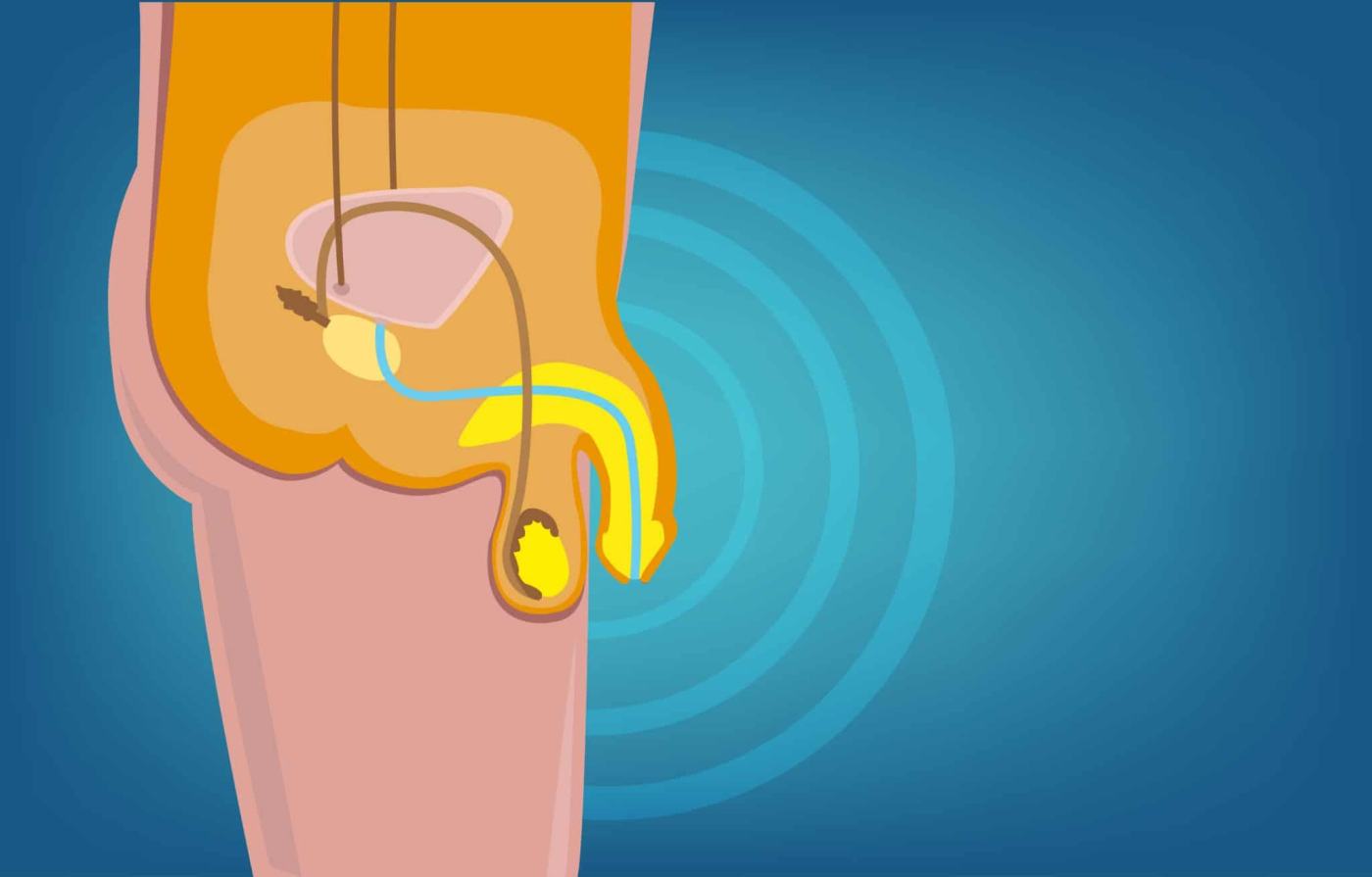 ये हैं पीनस से जुड़ी गंभीर बीमारियां, कभी न करें इन्हें नजरअंदाज