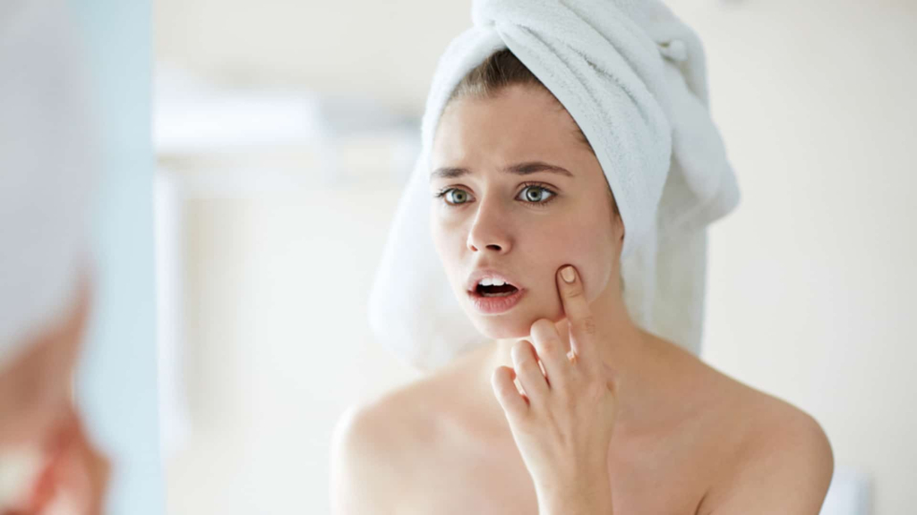स्किन प्रॉब्लम्स-skin problems