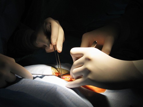 हार्ट बायोप्सी -heart biopsy
