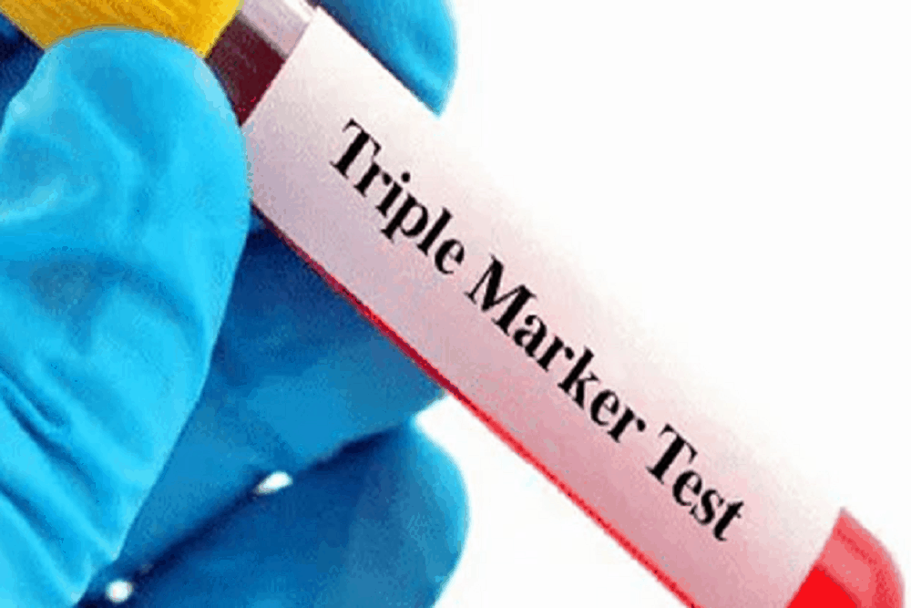 ट्रिपल मार्कर टेस्ट (Triple Marker Test) क्या होता है?