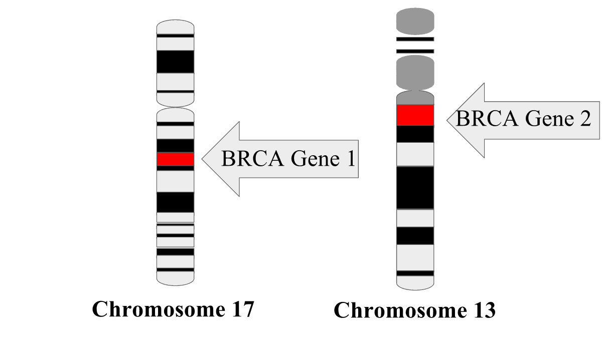 क्या होता है BRCA1 और BRCA2 जीन और ब्रेस्ट कैंसर से क्या है इसका संबंध?