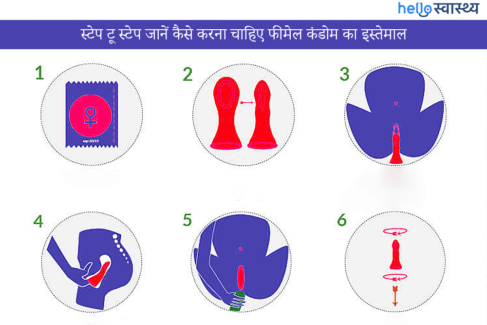 स्टेप-बाय-स्टेप जानिए महिला कॉन्डम (Female Condom) का इस्तेमाल कैसे करें