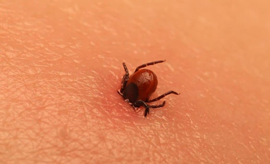 Congo Virus (कोंगो वायरस) : राजस्थान और गुजरात में बढ़ा मौत का आंकड़ा