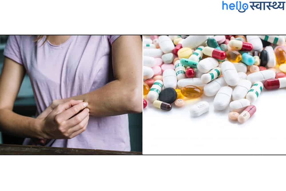 Desloratadine : डेस्लोरेटाडिन क्या है? जानिए इसके उपयोग, साइड इफेक्ट्स और सावधानियां