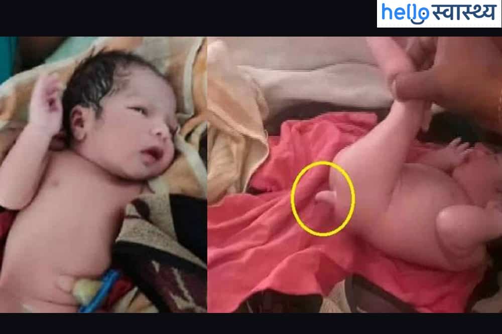 कभी नहीं सुना होगा ऐसी अजब गजब बीमारी के बारे में