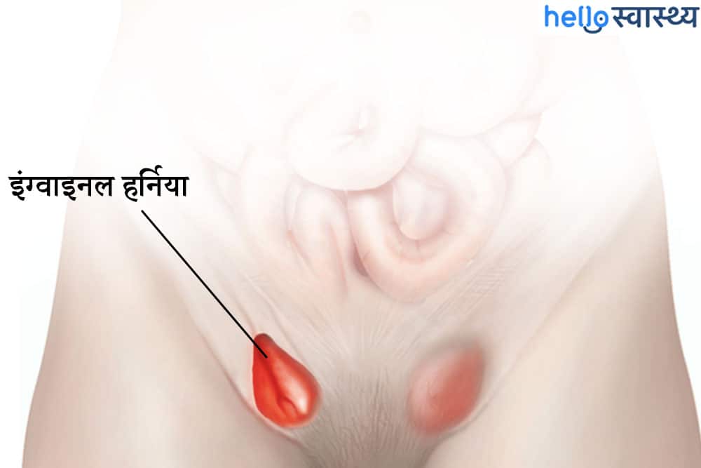 पेट के निचले हिस्से और अंडकोष में दर्द को भूलकर न करें नजरअंदाज