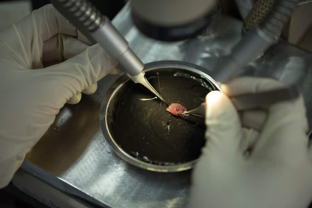 Heart Biopsy: हार्ट बायोप्सी क्या है?