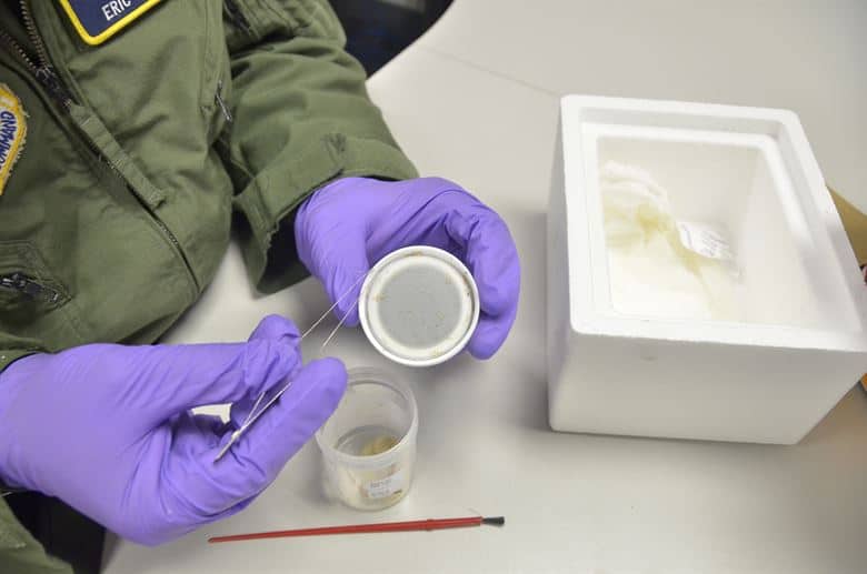 MRSA: मेथिसिलिन रेसिस्टेंट-स्टैफिलोकॉकस ऑरियस क्या है?