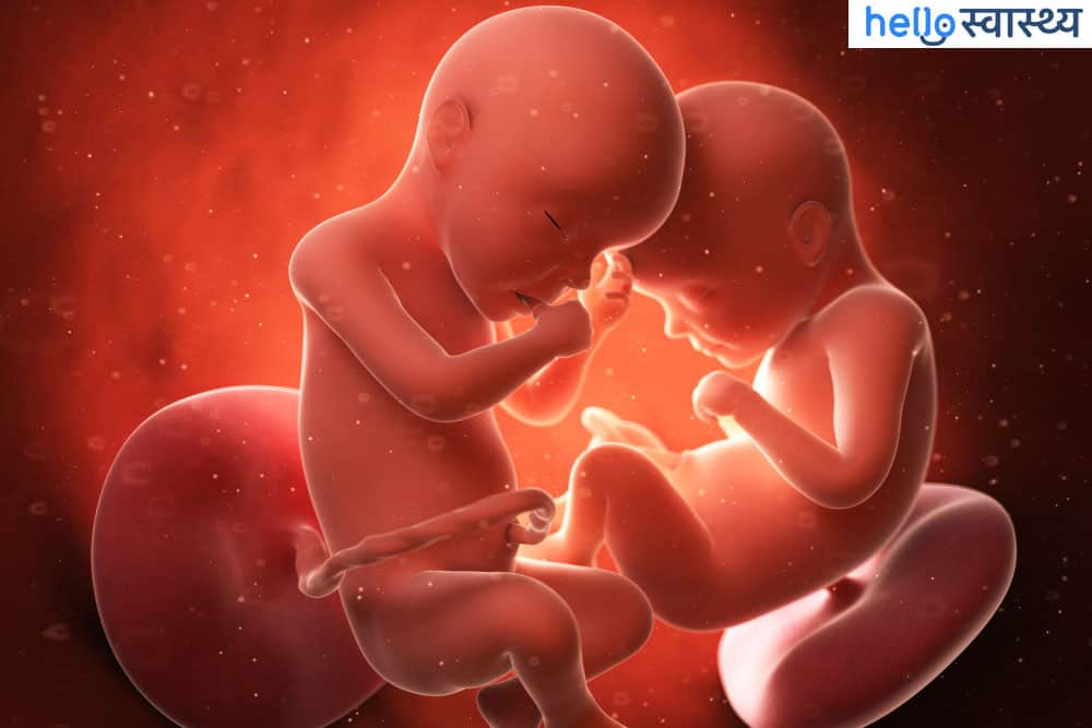 वैनिशिंग ट्विन सिंड्रोम (vanishing twin syndrome) : गर्भ में जुड़वां बच्चे में से एक की मौत हो जाए तो क्या होता है दूसरे के साथ?