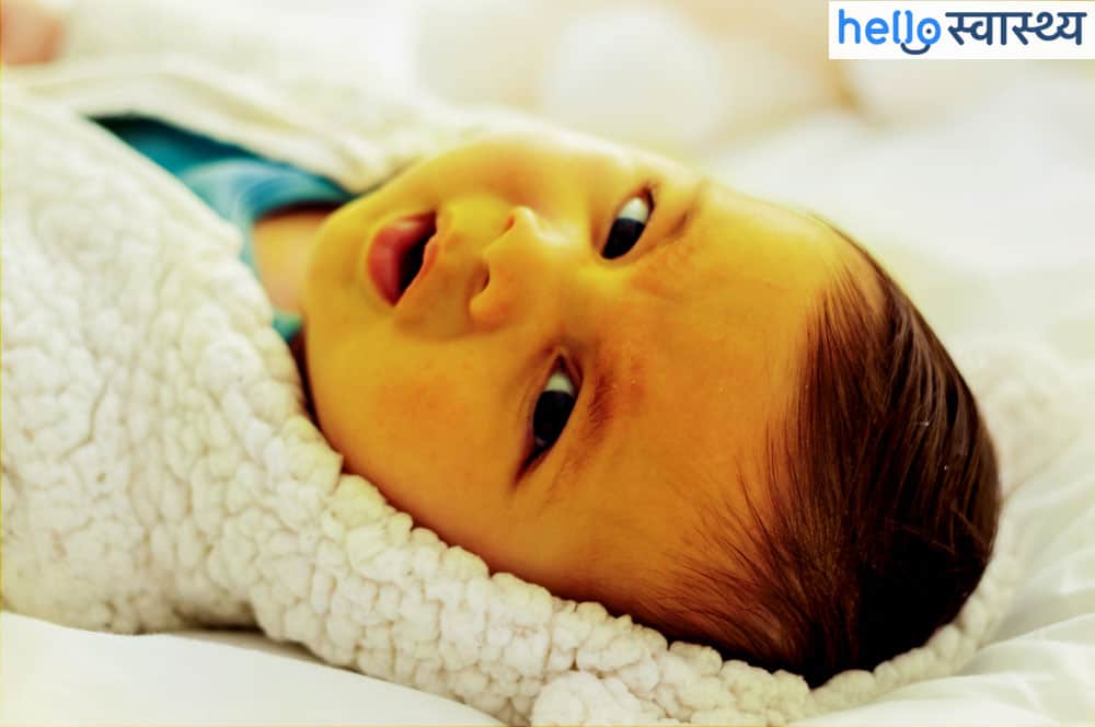 दिखाई दे ये लक्षण, तो हो सकता है नवजात शिशु को पीलिया