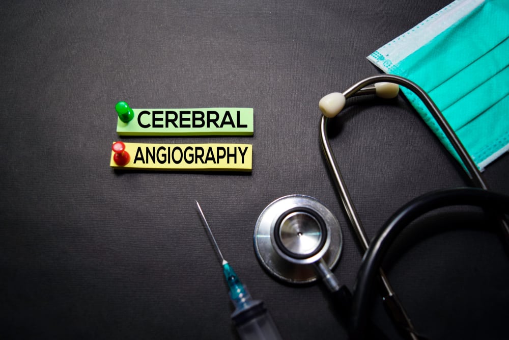 Cerebral Angiogram :सेरिब्रल एंजियोग्राम क्या है?