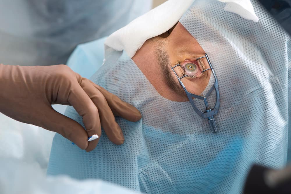 Glaucoma Surgery : ग्लॉकोमा सर्जरी क्या है?