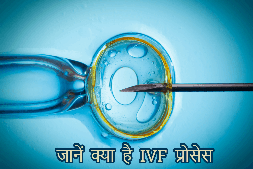 किन मेडिकल कंडिशन्स में पड़ती है आईवीएफ (IVF) की जरूरत?