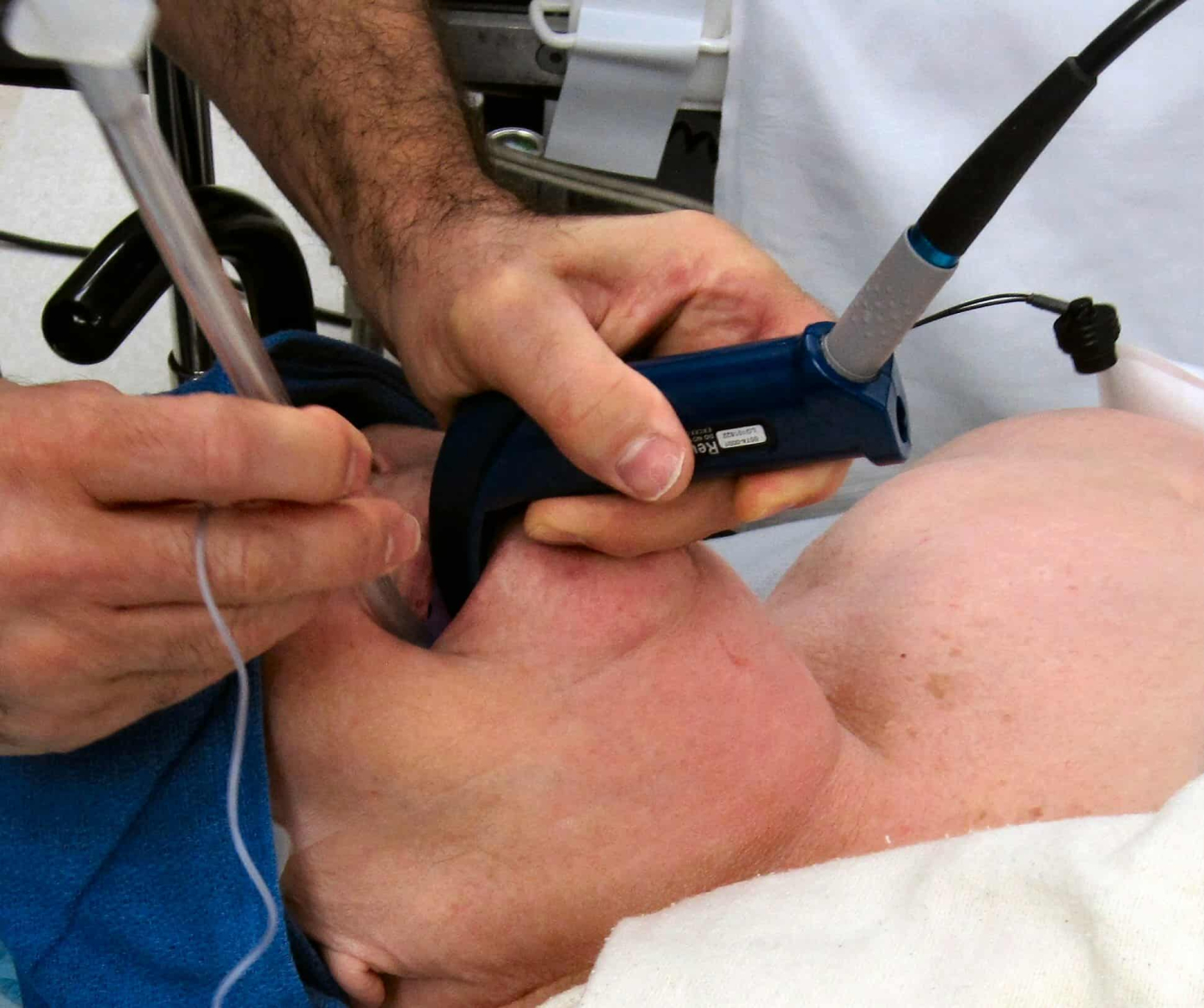 Laryngoscopy: लैरिंगोस्कोपी टेस्ट क्या है?
