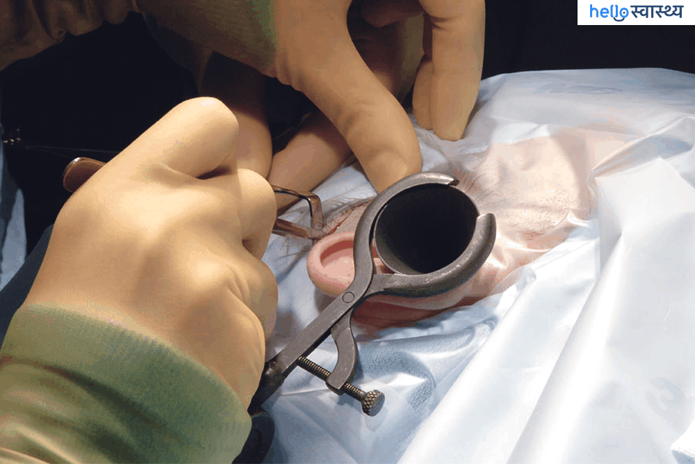 Tympanoplasty : टिम्पैनोप्लास्टी क्या है?