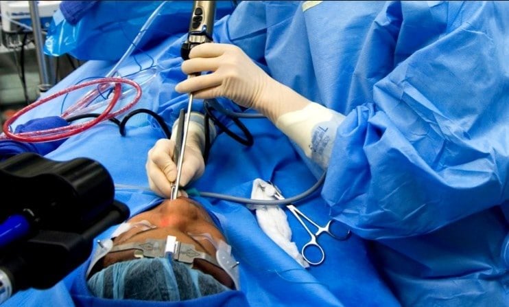Endoscopic Sinus Surgery: एंडोस्कोपिक साइनस सर्जरी क्या है?