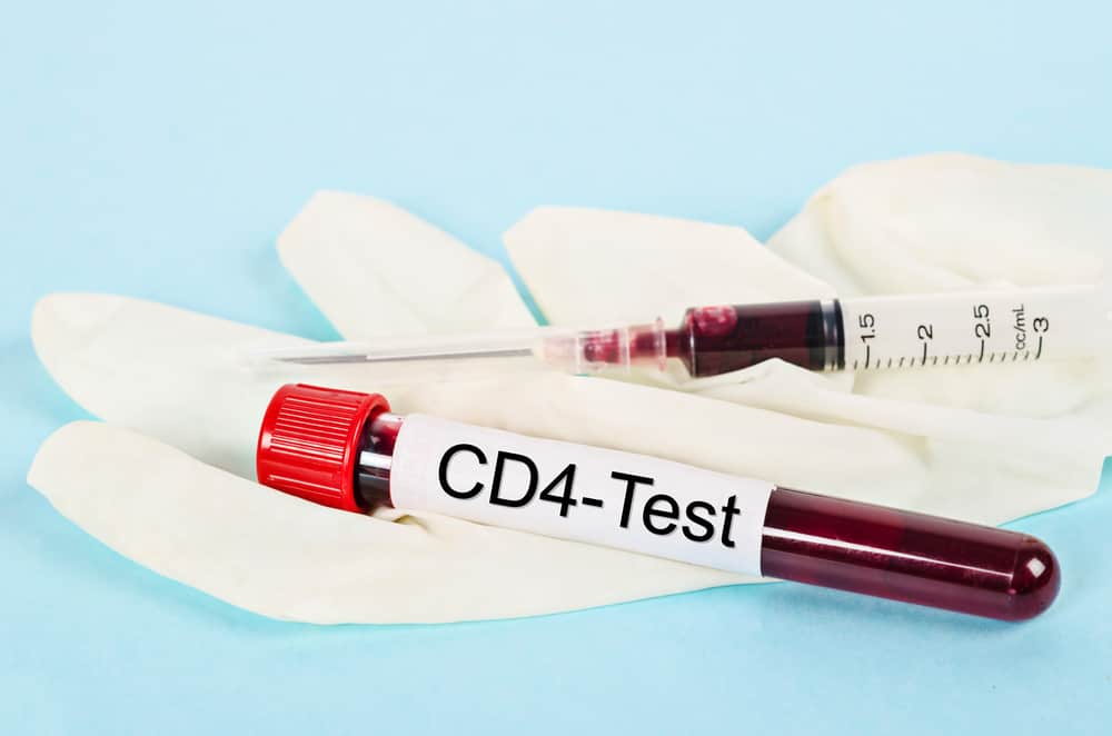 CD4 Count : सीडी 4 काउंट क्या है?
