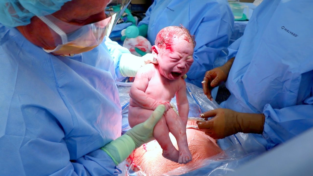 Vaginal birth and Good Bacteria