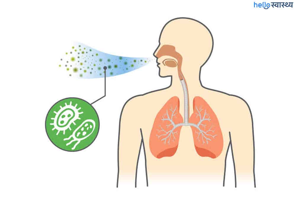 World Pneumonia Day : निमोनिया से 2030 तक 11 मिलियन बच्चों की मौत की आशंका