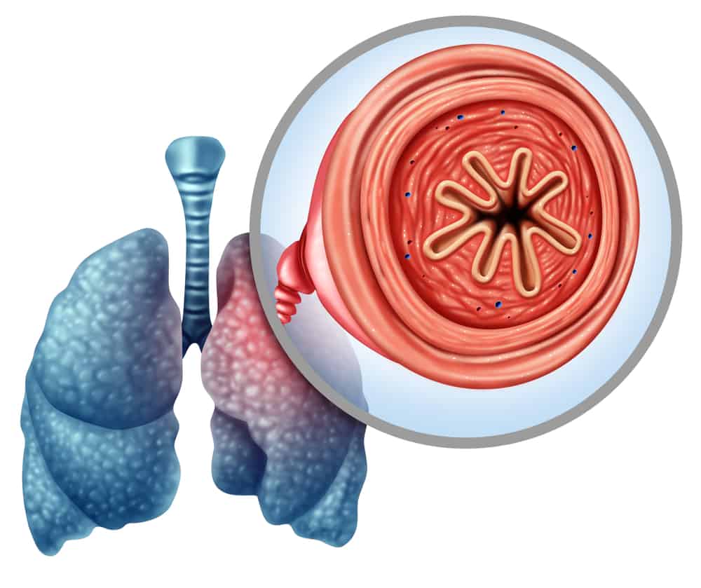World COPD Day: स्मोकिंग को बाय-बाय बोल कर सीओपीडी से बचें