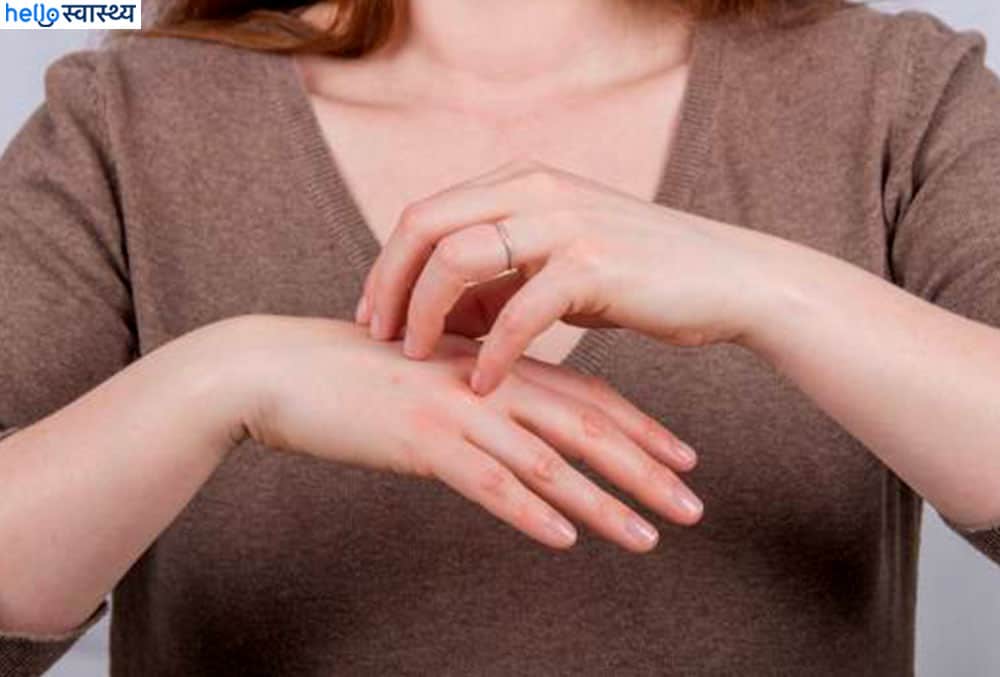 क्या गर्भावस्था में हथेलियों का लाल होना और उनमें खुजली सामान्य है?