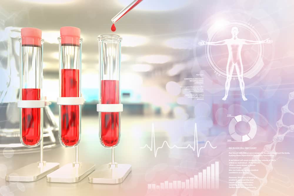 Calcium Blood Test : कैल्शियम ब्लड टेस्ट क्या है?