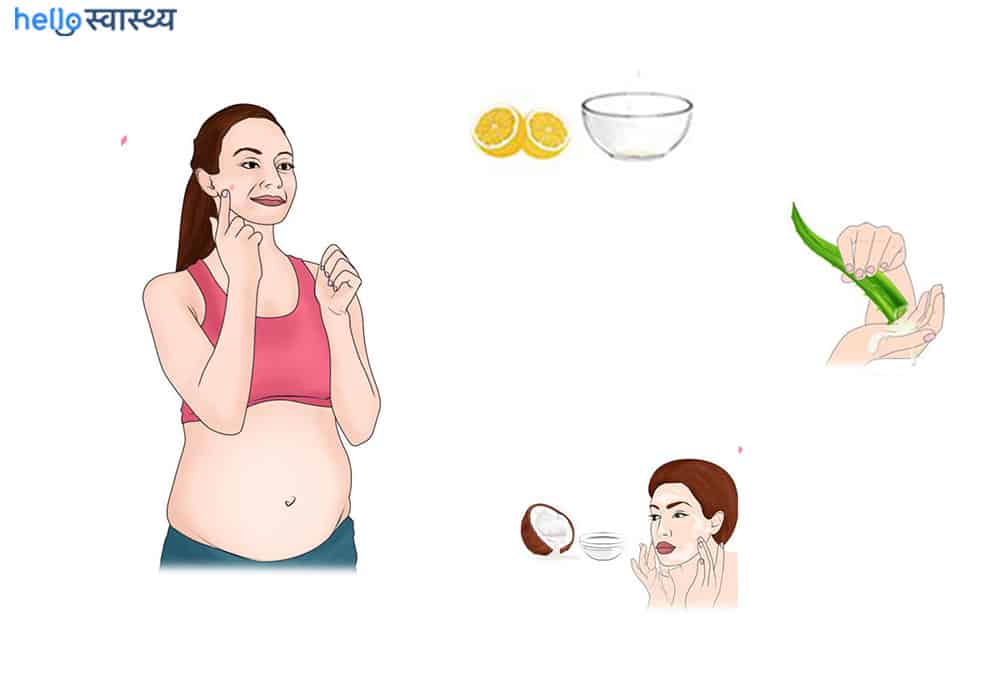 प्रेग्नेंसी के दौरान मुंहासे हैं तो घबराएं नहीं, अपनाएं इन घरेलू नुस्खों को