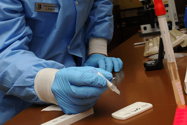 Monospot Test : मोनोस्पॉट टेस्ट क्या है?