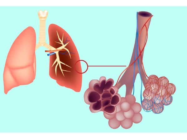 क्या है फुफ्फुसीय हाइपरटेंशन?