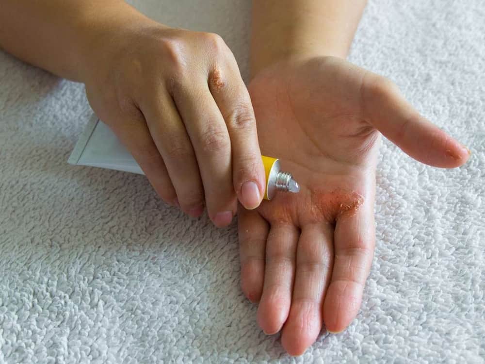 Surfaz Sn: सरफेज एसएन क्या है? जानिए इसके उपयोग, डोज और सावधानियां