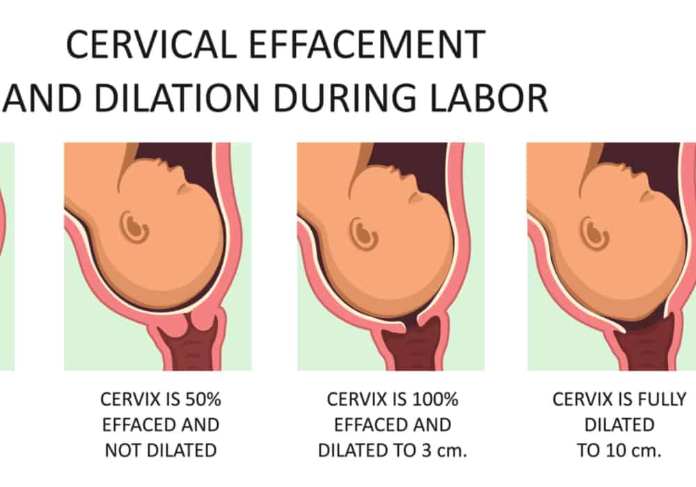 डायलेशन के समय बॉडी में क्या होता है?