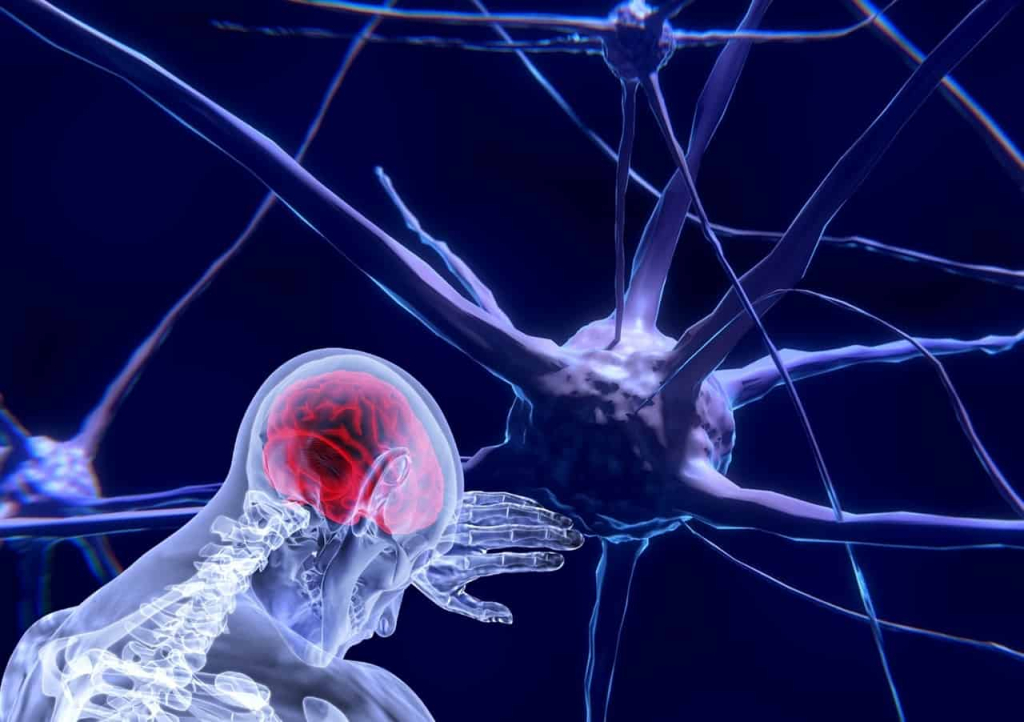स्ट्रोक की बीमारी_Brain Stroke ki bimari