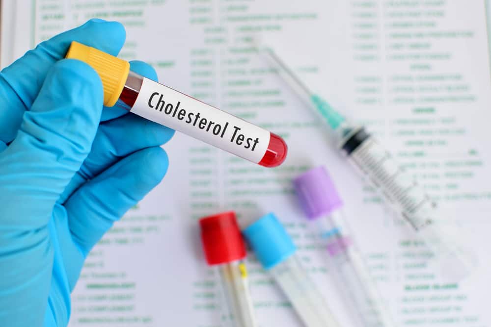 Cholesterol Test: कोलेस्ट्रॉल टेस्ट क्या है?