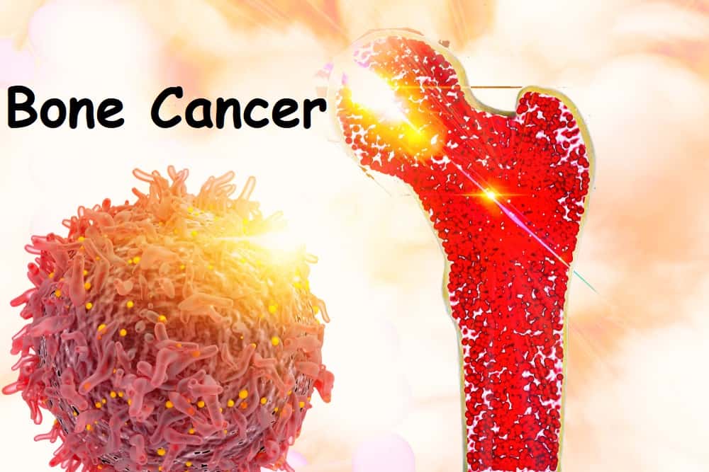 पैरों में होने वाला दर्द हो सकता है हड्डी का कैंसर, जान लें इसके बारे में सबकुछ