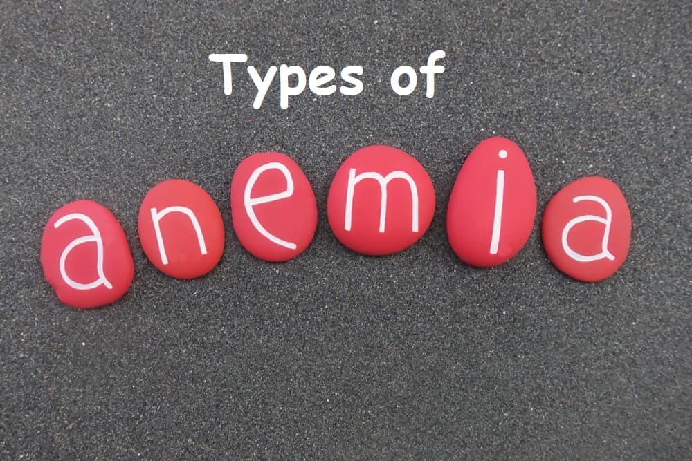 क्या आप एनीमिया के प्रकार के बारे में जानते हैं?