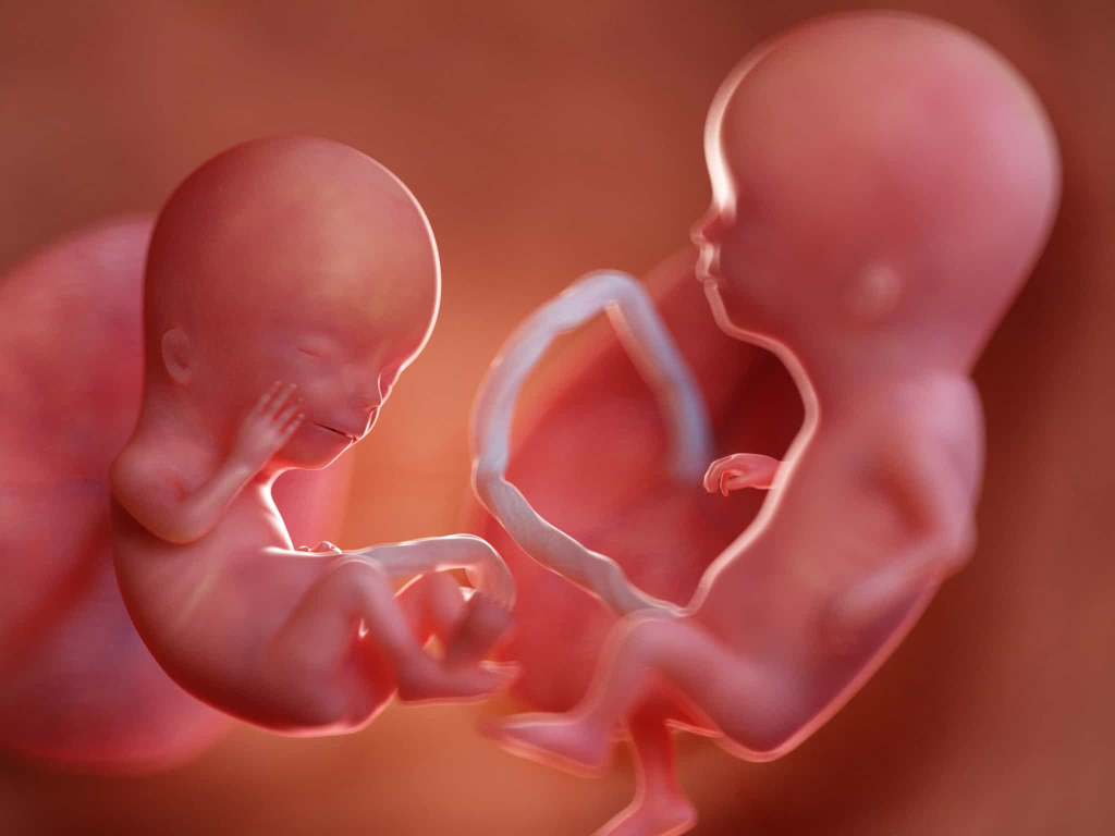 ट्विन्स बच्चे: गर्भवती महिला जान लें ये बातें