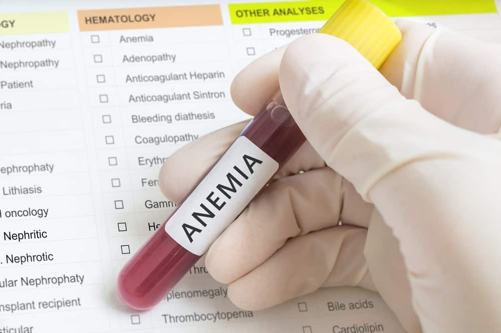 Anemia chronic disease: एनीमिया क्रोनिक डिजीज क्या है? जानिए इसके कारण, लक्षण और उपाय