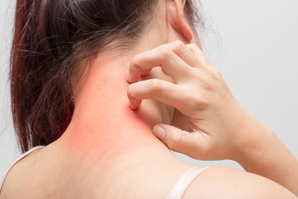 Skin Allergy Quiz