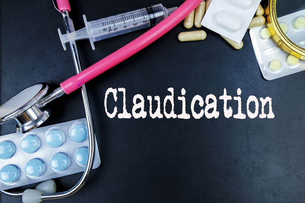 Claudication : क्लॉडिकेशन क्या है? जानें इसके कारण, लक्षण और इलाज
