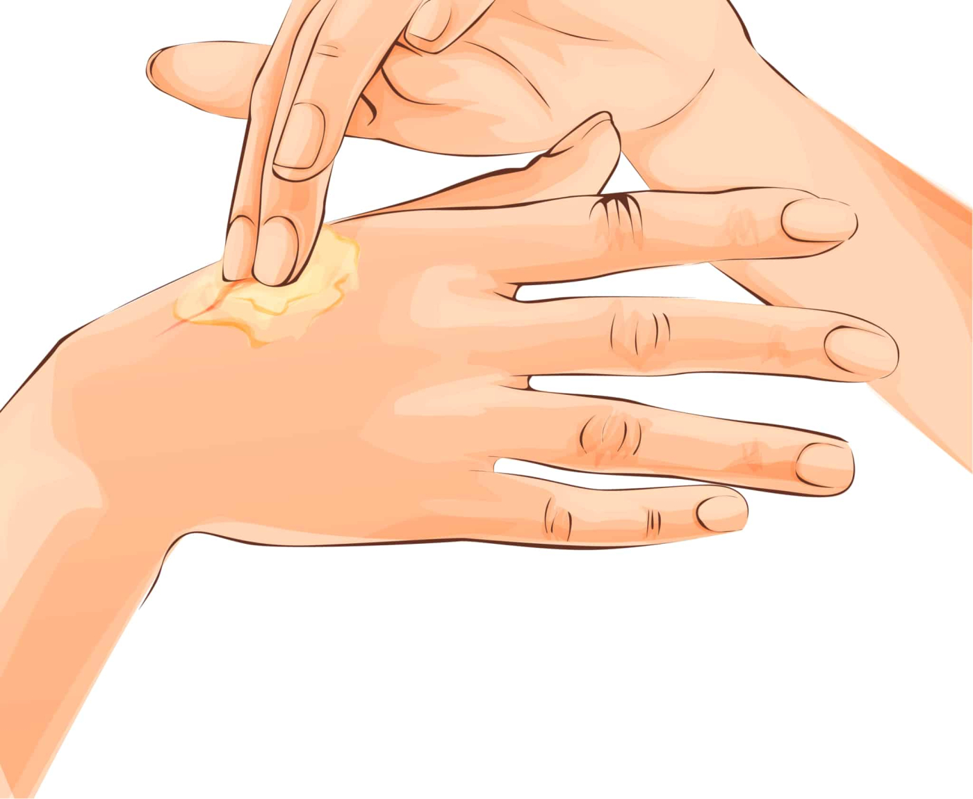 Choline Salicylate : कोलीन सैलिसिलेट क्या है? जानिए इसके उपयोग, साइड इफेक्ट्स और सावधानियां