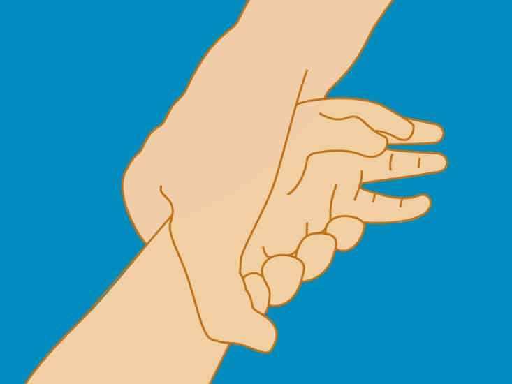 Nursemaid elbow: नर्समेड एल्बो क्या है?